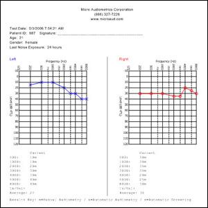 Earscan Printing Utility